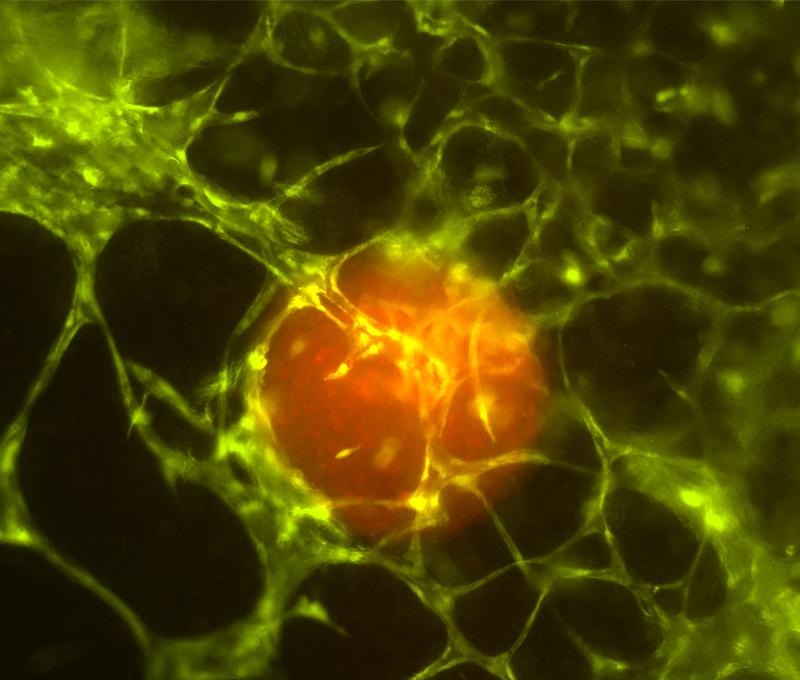 Rot fluoreszierende Tumorsphäre in biogedrucktem Gewebe. 