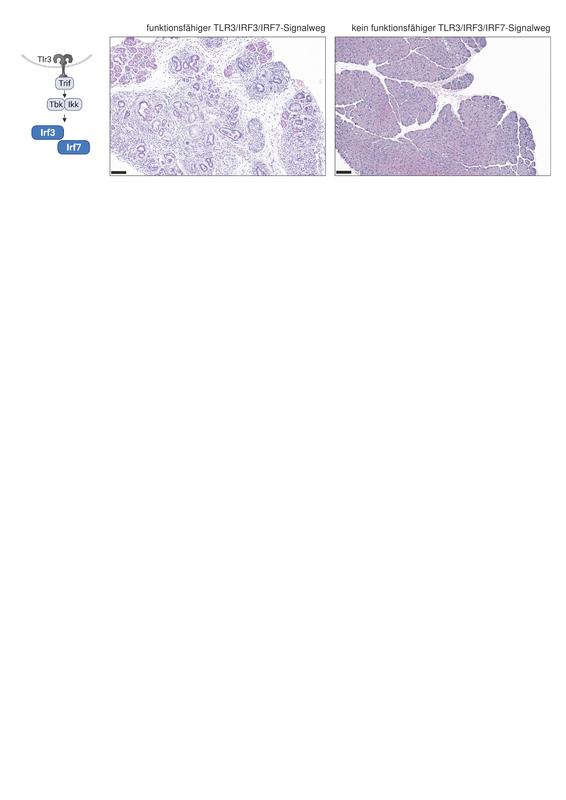 Schematische Übersicht des TLR3/IRF3/IRF7-Signalweg und Hämatoxylin-Eosin Färbungen von histologischen Gewebeschnitten der Bauchspeicheldrüse von genetisch-veränderten Mauslinien, Maßstabsbalken 100µm. Bei funktionsfähigem TLR3/IRF3/IRF7-Signalweg entwicke