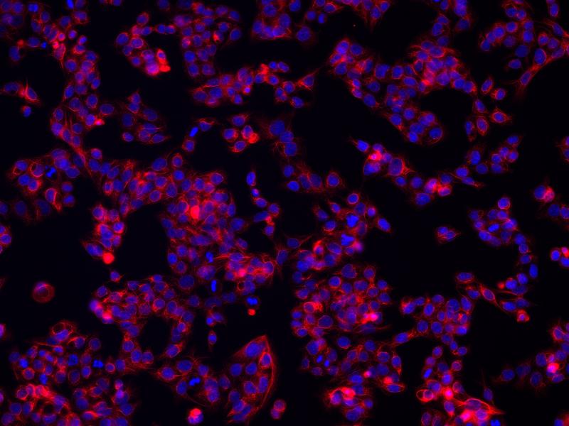 Staining of liver cells. CYP2C9 (red) is an important drug-metabolizing enzyme in the human liver. The cell nuclei are stained blue. 