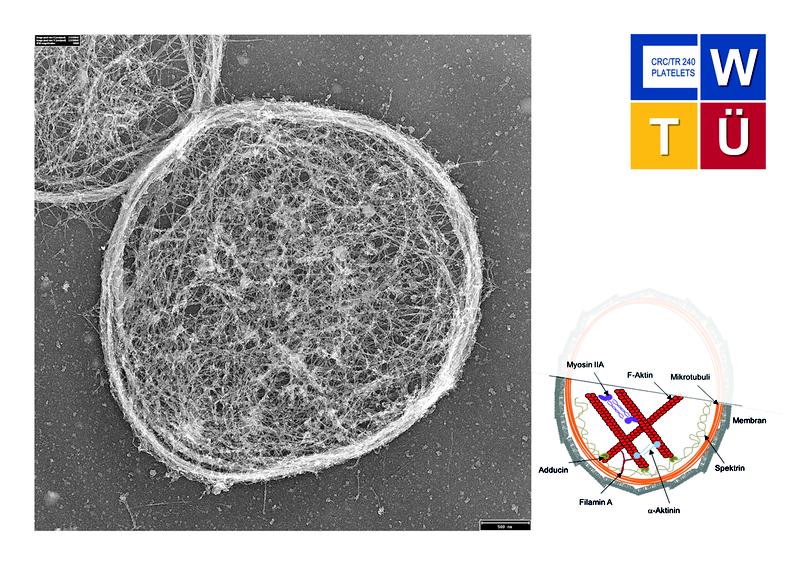 Im Rahmen SFB/TRR240 wurde anhand neu entwickelter biophysikalischer Methoden gezeigt, dass das Zellskelett von Thrombozyten in seiner Funktion, Kräfte auszuüben, eingeschränkt ist
