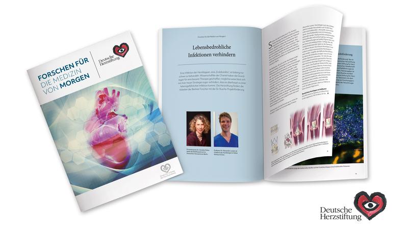 Über die Forschungsförderung der Deutschen Herzstiftung und der Deutschen Stiftung für Herzforschung informiert die Broschüre „Forschen für die Medizin von morgen“.