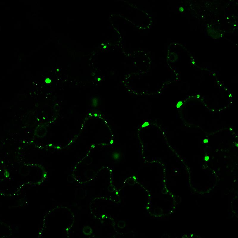 Im mikroskopischen Bild wurden die Komponenten zum Leuchten gebracht, die in den Zellen der Tabakpflanze an der Autophagie beteiligt sind und durch krankheitserregende Xanthomonas-Bakterien abgebaut werden. 