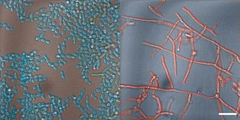 Candida albicans in its harmless (left) and its infectious (right) form. The white bar corresponds to 20 micrometers.
