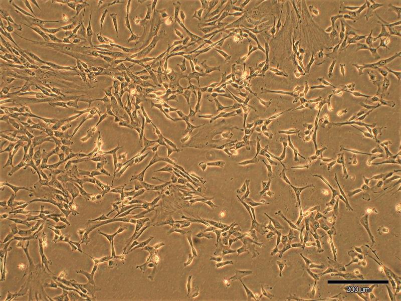  Mikroskopische Aufnahme der kultivierten menschlichen mesenchymalen Stammzellen aus der Spender-Nabelschnur, deren Stammzellprodukte im konditionierten Medium für diesen Therapieansatz verwendet wurden.