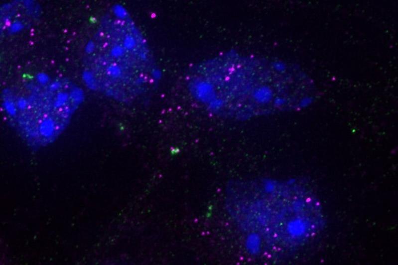 Abbildung spezifischer RNAs (in Magenta) am Zentrosom (in Grün) in Kortexzellen der Maus. Der Zellkern ist blau eingefärbt. 