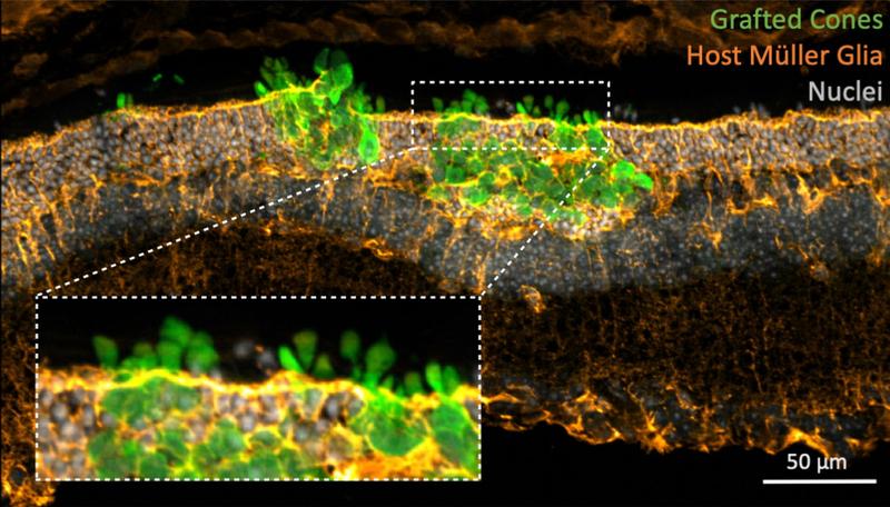 Transplantierte menschliche Zapfenphotorezeptoren (in grün) werden in die degenerierte Netzhaut der Maus inkorporiert. Unterstützende Zellen in der Wirtsnetzhaut (Müller-Glias, in orange) interagieren eng mit dem Transplantat.
