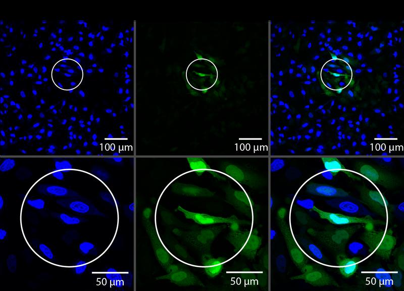 Räumliche Kontrolle der Translation von eGFP in HeLa Zellen: Nur die bestrahlten Zellen (innerhalb des Kreises) zeigen grüne Fluoreszenz vom eGFP und deuten damit auf erfolgreiche Translation hin.