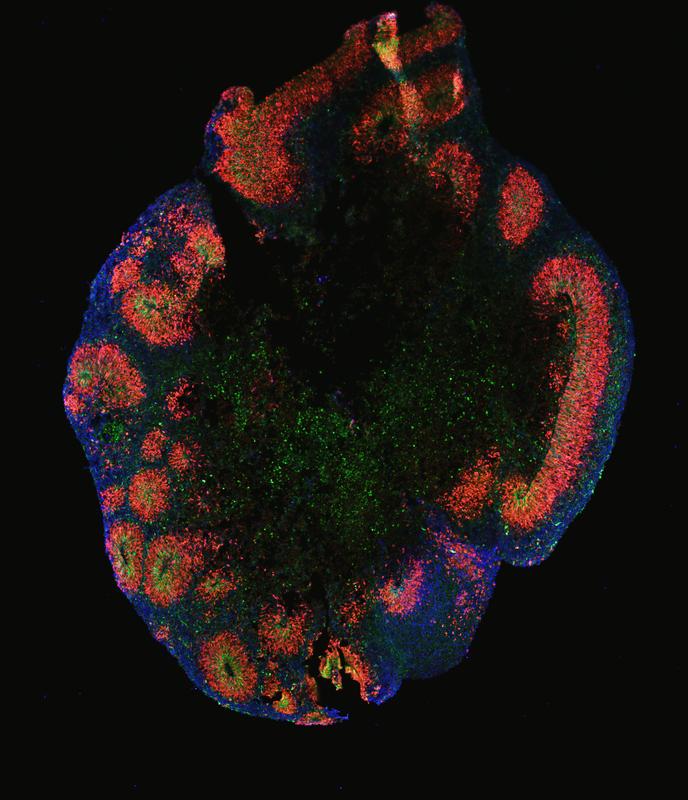 Organoid der menschlichen Großhirnrinde unter dem Mikroskop, gefärbt mit Fluoreszenzfarbstoffen. Die "Mini-Gehirne" wurden mit iPS-Zellen und einer kurzzeitigen Dreifach-Hemmung hergestellt. 