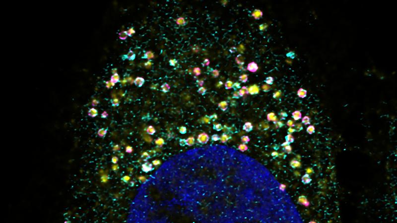 Bild aufgenommen mit dem Konfokalmikroskop: Inneres einer menschlichen Zelle mit geschädigten Lysosomen (magentafarbene Kreise) und Calponin 2, das die geschädigten Lysosomen umgibt (hellblaue Form darum). Der Zellkern ist als blauer Halbkreis zu sehen.