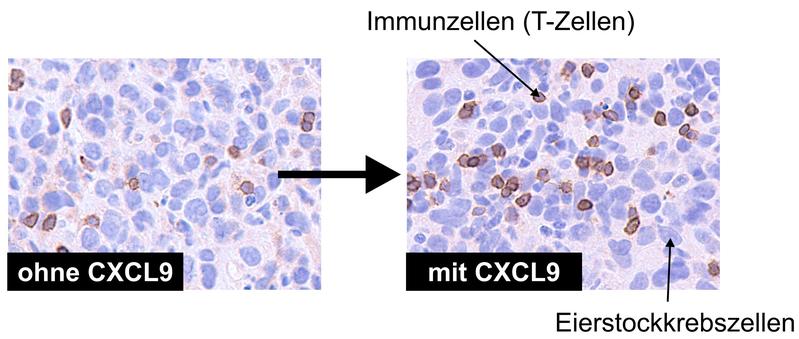 Der Botenstoff CXCL9 (ein Chemokin) verbessert die Einwanderung von Immunzellen in Eierstockkrebstumore: ohne CXCL9 (linkes Bild) finden sich nur vereinzelt T-Zellen im Tumor, während ihre Zahl deutlich zunimmt, wenn die Tumorzellen CXCL9 produzieren 