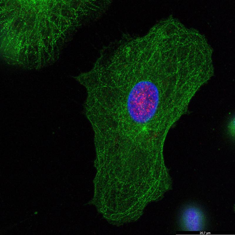 Monozyten-abgeleitete dendritische Zellen (MDDCs) eines gesunden Spenders, gefärbt für PQBP1 (rot) und die zelluläre Strukturkomponente Tubulin-beta (grün). Das Kernkompartiment ist blau gefärbt. 