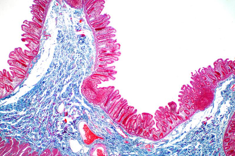 Foto eines mikroskopischen Querschnitts von Darmzotten und Darmepithel. 