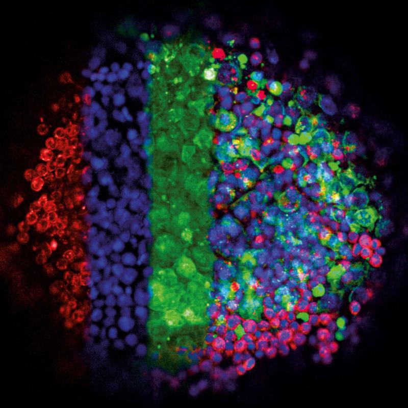 Fluoreszenzaufnahme der Interaktion von Keimzelltumor-Zellen (grün) und Endothelzellen (rot) in einem 3D-Kultursystem (Zellkerne blau). Die linke Hälfte zeigt die einzelnen Zellpopulationen, die rechte Seite deren Interaktion.