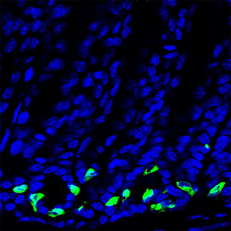 Die mikroskopische Aufnahme zeigt die Magenschleimhaut mit grün gefärbten Gastrin-produzierenden Zellen. 