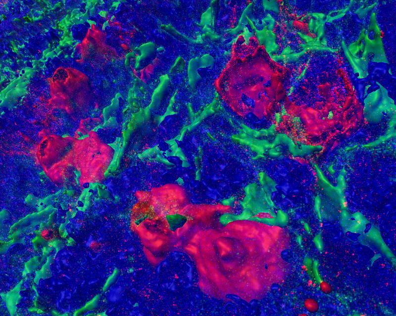 Detaillierte dreidimensionale Darstellung mehrerer rot markierter CD30-positiver Lymphozyten in einem entzündeten Lymphknoten. Aktinfilamente, die das Gewebe durchziehen, sind zur Abgrenzung grün markiert. Die blaue Färbung markiert andere Zellen.