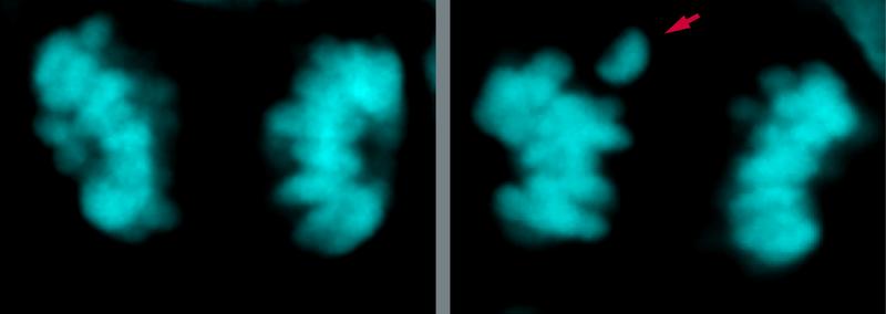 Mikroskopaufnahme der Chromosomen (in Cyan) einer neuronalen Stammzelle des modernen Menschen im Neokortex während der Zellteilung. 