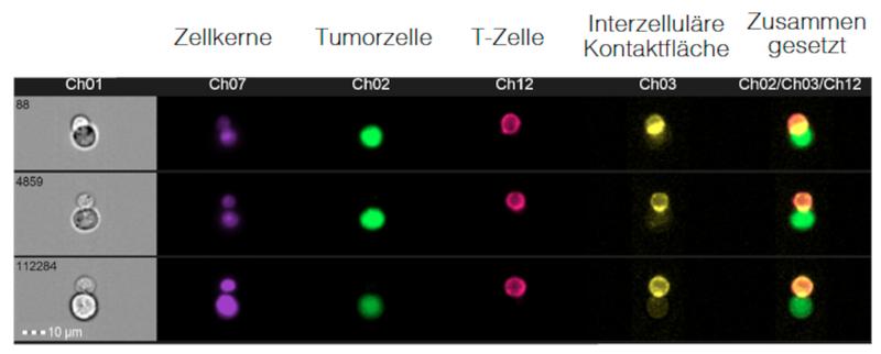 Konjugatbildung zwischen Tumorzelle (Grün) und T-Zelle (Magenta) .In Gelb dargestellt ist das Molekül LFA-1, welches als Klebstoff für die Konjugatbildung wichtig ist.