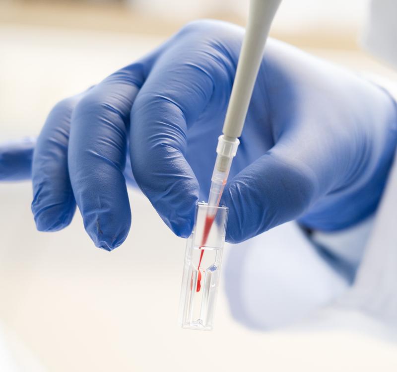 Im Erythrozytenlabor des Universitätsklinikums Würzburg werden die Blutproben für die Messung der Enzymaktivität in roten Blutkörperchen vorbereitet.