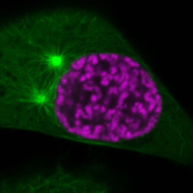 Organization of mitotic chromosomes and spindle microtubules at an early phase of cell division.