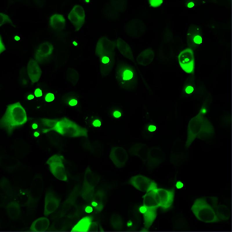 Das Bild zeigt humane Zellen, die fluoreszenz-markiertes mutiertes Huntingtin herstellen. Mutiertes Huntingtin neigt zur Anhäufung, die pathologisch ist und durch Punkte sichtbar wird. 
