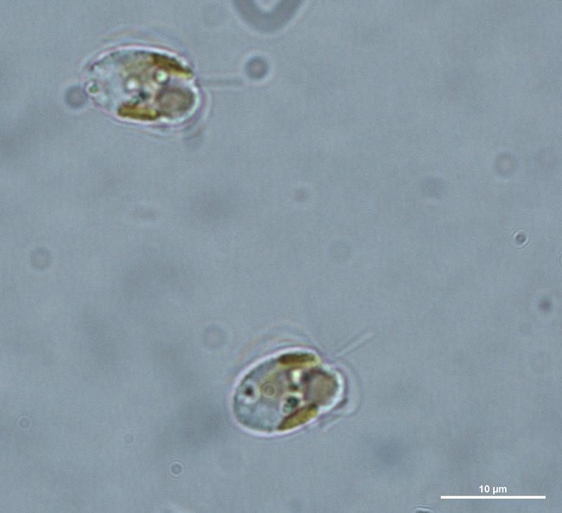 Prymnesium parvum aus der Oder bei Hohenwutzen, 15.08.2022