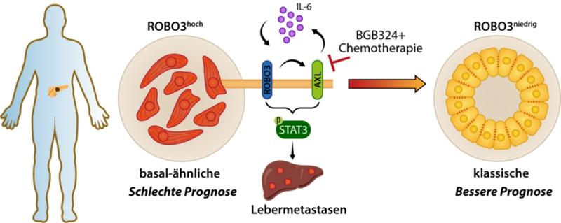 Abbildung: ROBO3-vermittelte Subtypenspezifität bei Bauchspeicheldrüsenkrebs. 