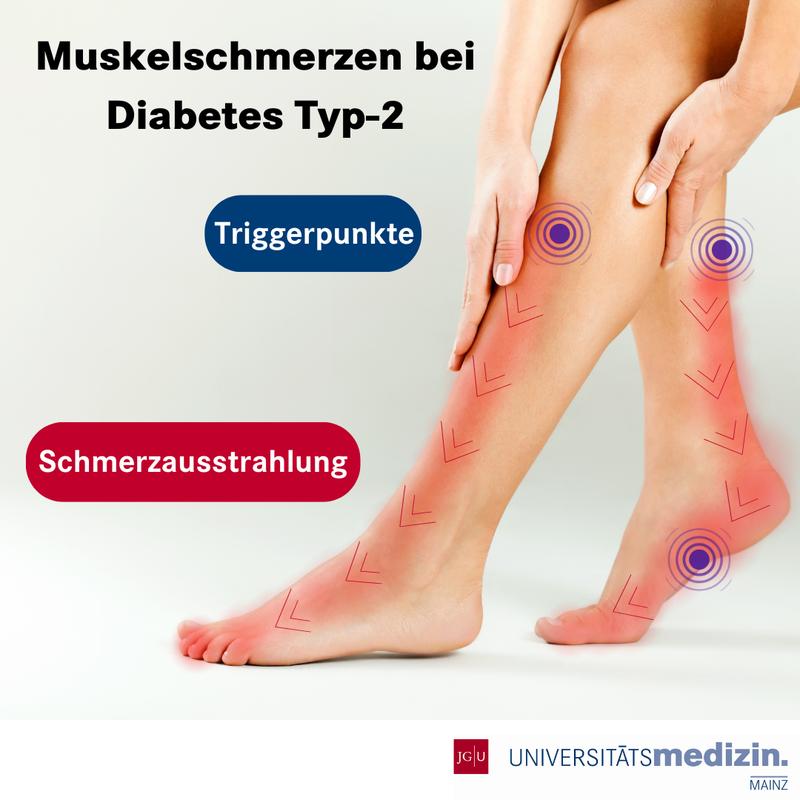Schmerzen bei Diabetes können nicht nur nervlich sondern auch muskulär bedingt sein. Durch diese Erkenntnis der Mainzer Forschenden können Betroffene mit beiden Schmerzformen gezielter behandelt werden.
