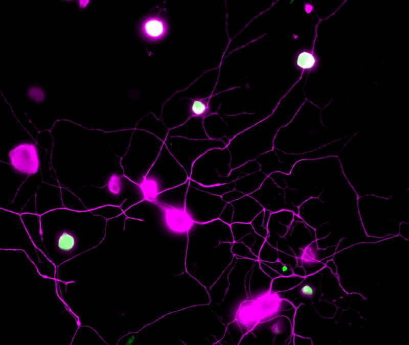 Visualisierung von Schmerz in sensorischen Neuronen der Maus (I)