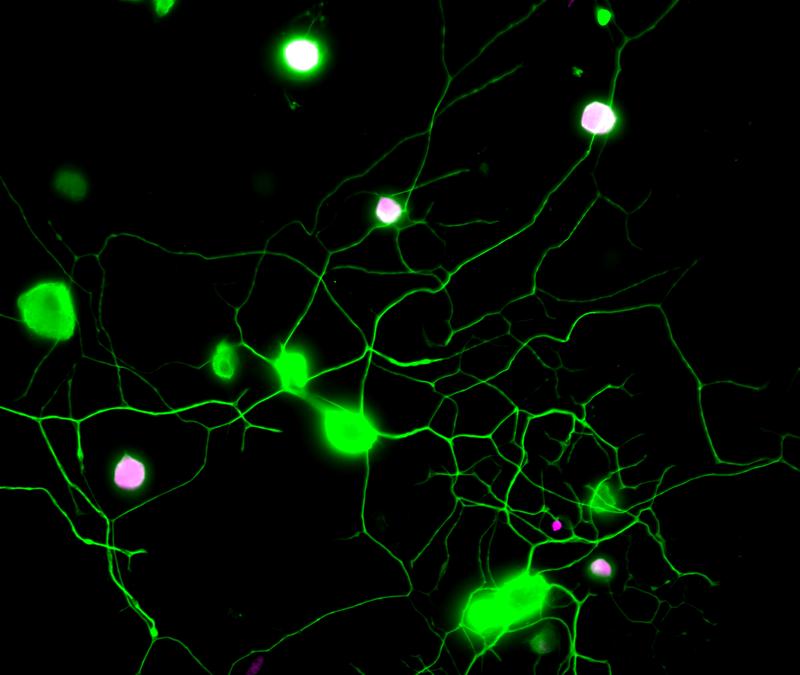 Visualisierung von Schmerz in sensorischen Neuronen der Maus (II)