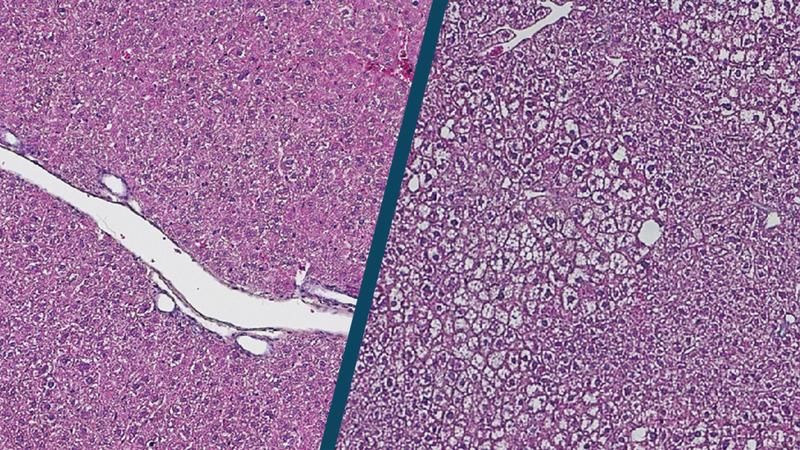 The structure of the liver changes with age. Shown here is a histology image of young (left) and old (right) liver cells.