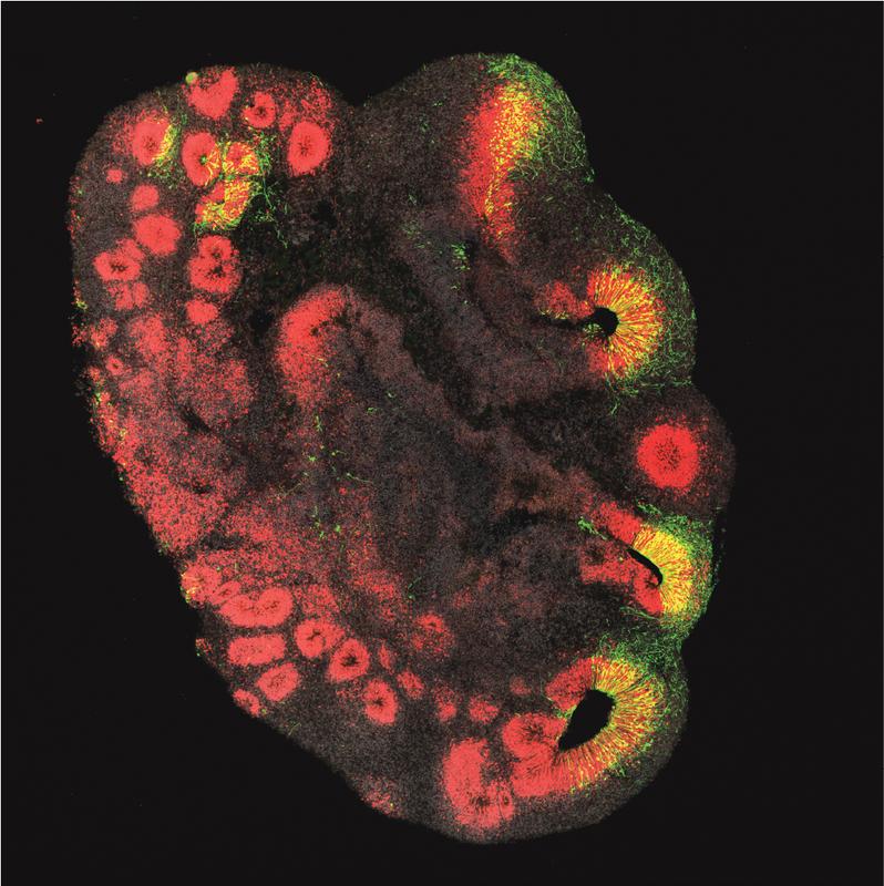 A brain organoid about 3 millimeters in size made from stem cells of a chimpanzee. The brain stem cells are stained red; brain stem cells that received the ARHGAP11B gene are shown in green. 