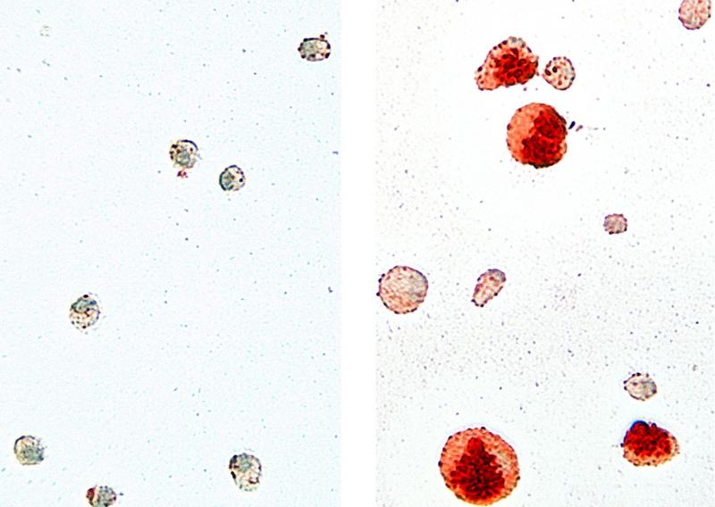 Alveolarmakrophagen isoliert aus der Lunge von Wildtyp Mäusen (links) und Cebpb-defizienten Tieren (rechts). Zellen ohne Cebpb sehen im Vergleich groß und aufgebläht aus, darin lagern sich viele Lipide ab (rot).
