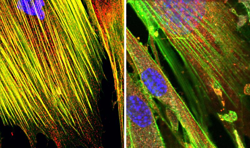 Lichtmikroskopieaufnahme von primären humanen Lungenzellen (links: nicht infiziert, rechts: Infektion mit RNA-Viren))