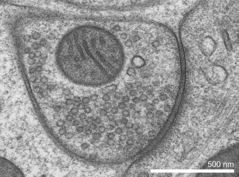 Die Abbildung zeigt eine elektronenmikroskopische Aufnahme einer hemmenden Synapse. Die zahlreichen synaptischen Vesikel mit einem Durchmesser von etwa 40 Nanometern werden vom molekularen Transporter VGAT mit dem GABA-Botenstoff befüllt.