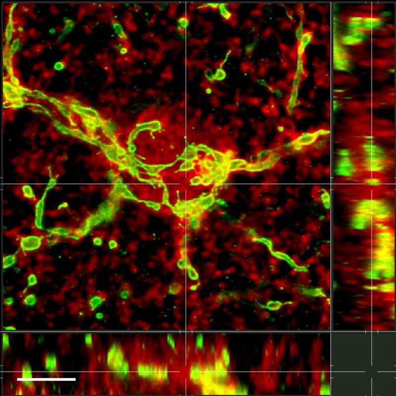 Die Abbildung zeigt eine konfokale lichtmikroskopische Aufnahme eines Gehirnschnitts: Astrozyten (rot) enthalten besonders viele Mitochondrien (grün), wenn den Tieren eine fettreiche, ketogene Diät verabreicht wurde.
