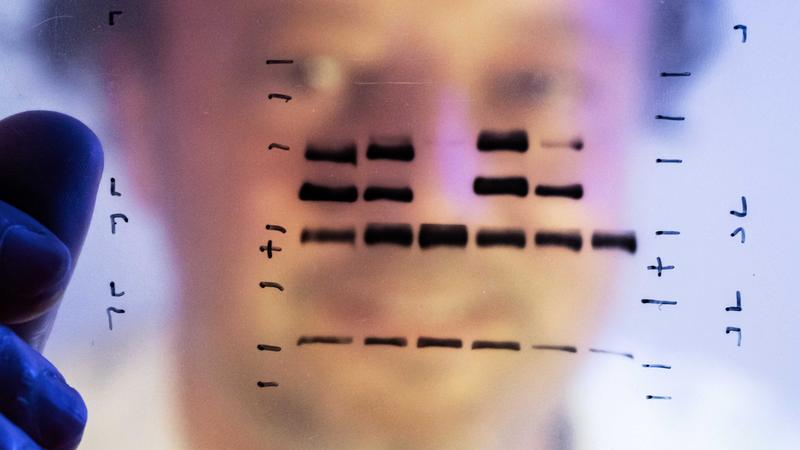 Dr Christian Kosan is examining proteins after separation in an electrophoresis. His team has discovered a novel therapeutic approach for treating malignant tumours of the lymphatic system.