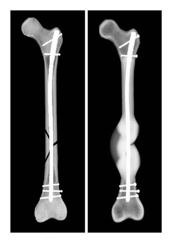 Computersimulation des Heilungsverlaufs eines Beispielpatienten.  