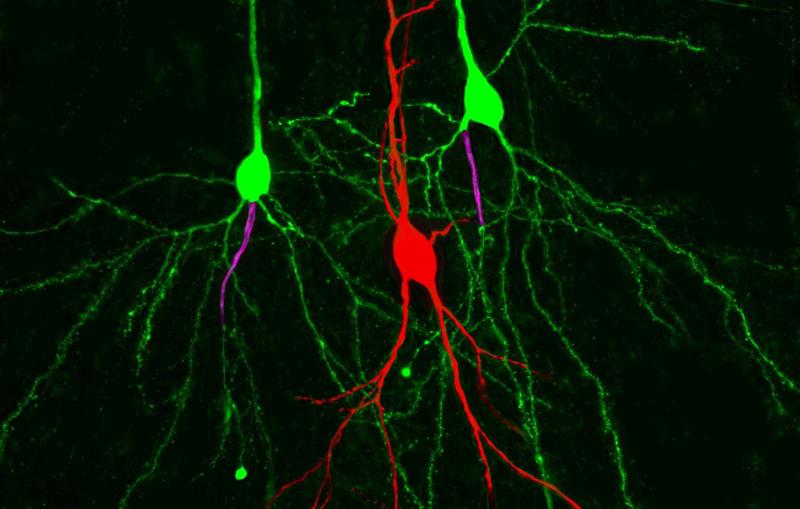 Pyramidenzellen im Hippocampus (grün): Bei der linken Zelle entspringt das Axon (pink) direkt am Zellkörper, bei der rechten Zelle an den Dendriten.