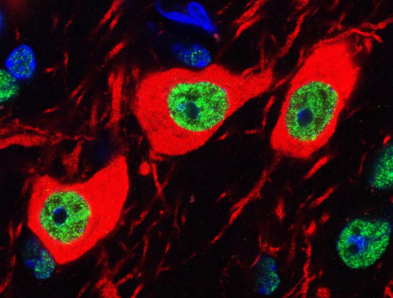 Fluoreszenzmikroskopische Aufnahme von Dopamin-ausschüttenden Neuronen in Mittelhirn-Schnitten der Maus. Der Zellkörper ist immunfluoreszenzmarkiert in rot
