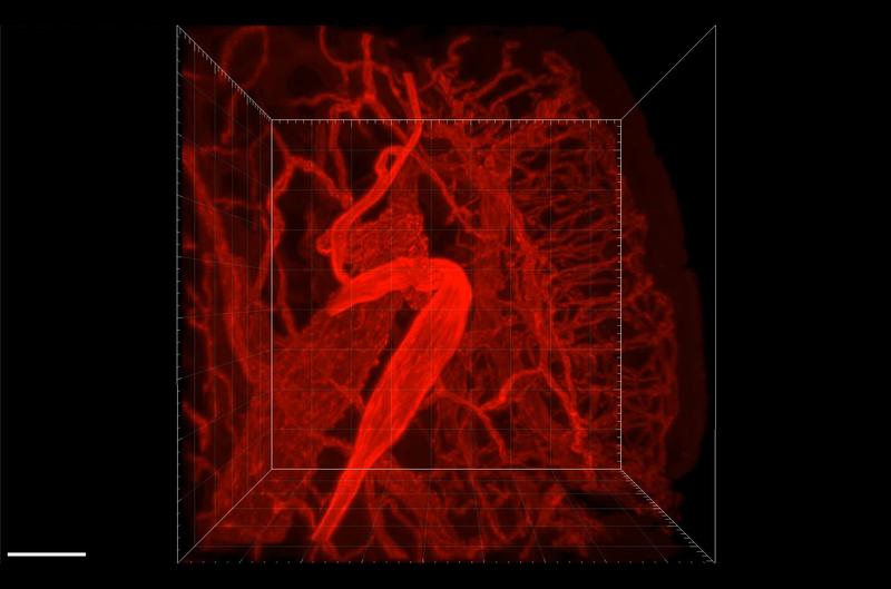 Das Forschungsteam um Professor Dr. Ulrich Steinhoff erzeugte mikroskopische Bilder von den Gefäßen der Darmwand, um zu analysieren, wie sich deren dreidimensionales Geflecht entwickelt, wenn ausgewählte Bakterien den Verdauungstrakt besiedeln.  