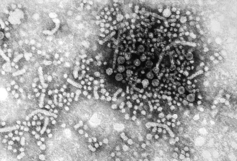 Transmission electron micrograph image of hepatitis B virus particles.