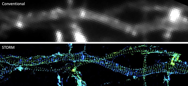 3D-STORM-Bilder (unten) von Aktin in Nervenzellfortsätzen enthüllten einen neuen Teil des Zellskeletts, den bisherige Lichtmikroskope (oben) nicht zeigen konnten. 