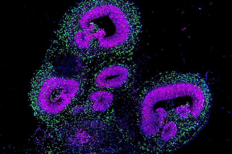  Gehirn-​Organoid aus menschlichen Stammzellen unter dem Fluoreszenzmikroskop: das Protein GLI3 (violett) markiert neuronale Vorläuferzellen in Vorderhirn-​Regionen des Organoids. Nervenzellen sind grün gefärbt.