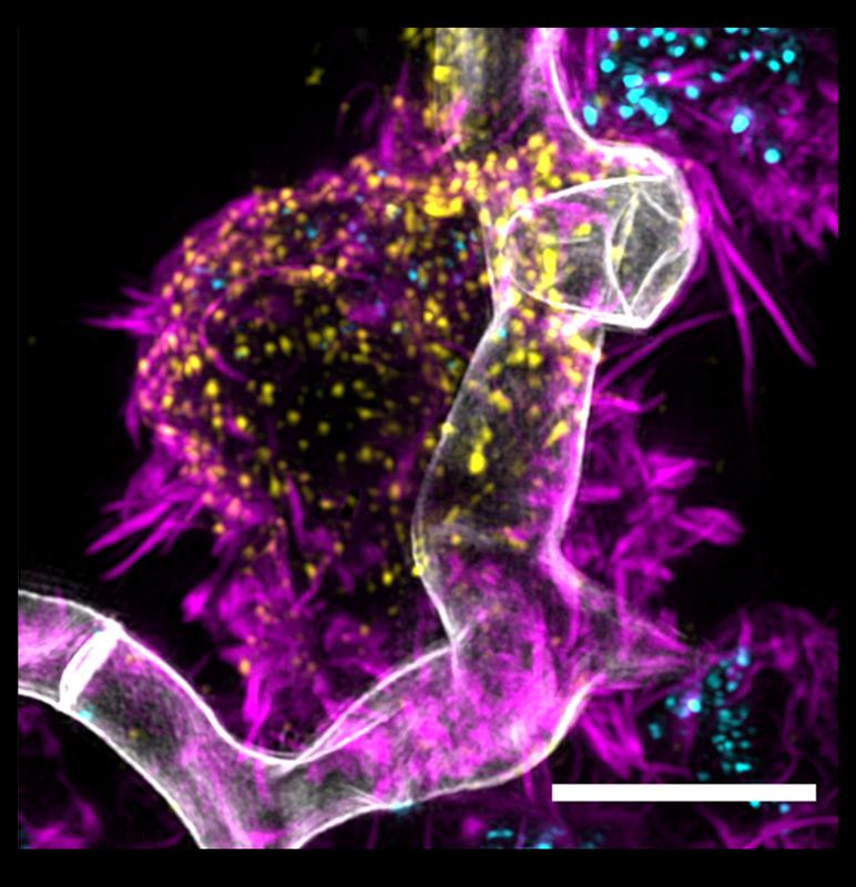 Pilz-CAR-T-Zell-Interaktion: in grau Aspergillus fumigatus, in Magenta CAR-T-Zellen, in Gelb die chimären Antigenrezeptoren, in hellblau bestimmte körpereigene Botenstoffe, welche die CAR-T-Zellen bei Interaktion mit dem Pilz produzieren und ausschütten.