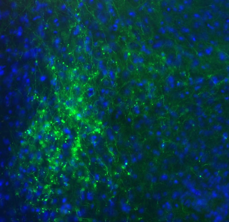 Neurons in the mouse visual system: Green: genetically labeled inhibitory neurons.