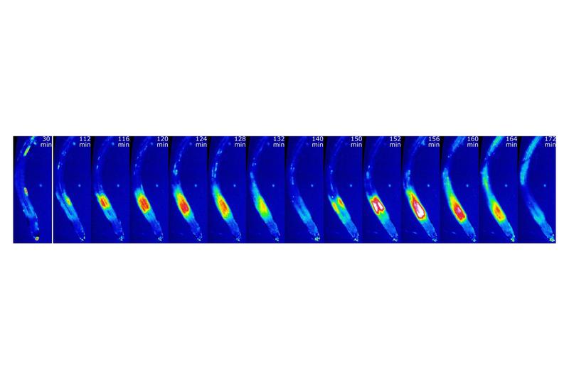 Arabidopsis-Pflanzen bei Manganmangel; die Veränderungen der zytoplasmatischen Kalziumkonzentration wurden mithilfe des Kalzium-Biosensors GCaMP6f-mCherry sichtbar gemacht. 