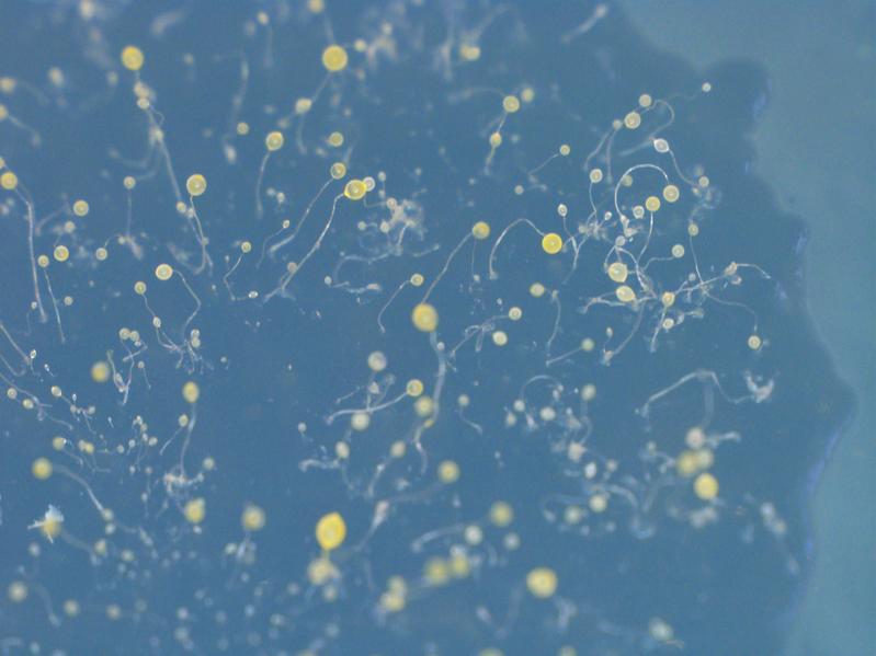 Mikroskopische Aufnahme der Fruchtkörper von D. discoideum auf einer Agarplatte. An der Spitze des multizellulären Organismus, wo sich auch die ruhenden Sporen befinden, ist das gelbe Pigment sichtbar. 