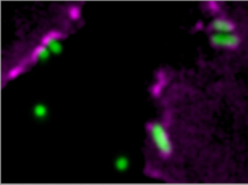 Kombination aus zwei fluoreszenzmikroskopischen Aufnahmen von Pseudomonas aeruginosa Bakterien (grün), die menschliche Zellen infizieren. Septin-Moleküle im Inneren der Zellen (magenta) reichern sich bei Kontakt mit den Bakterien an.