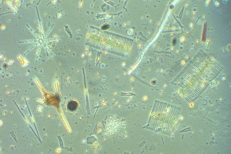 Blick durchs Mikroskop auf die vielfältige Mikroalgengemeinschaft eines Sees – zu sehen sind verschiedene Kieselalgen (Diatomeen), Grünalgen und Panzergeißeltierchen (Dinoflagellaten).