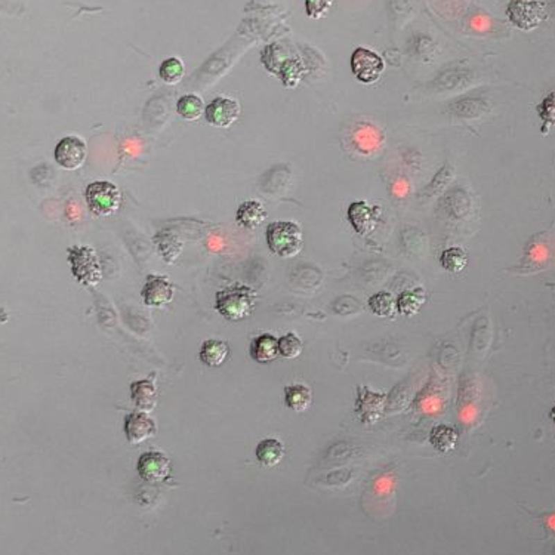 In human skin cells, inflammasomes (green) are assembled as a result of a ribotoxic stress response. Later, red dye flows into the cell through the "holes" that these create. 